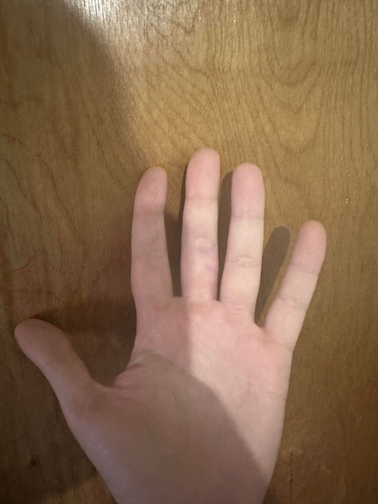 Hand In Front Of Door